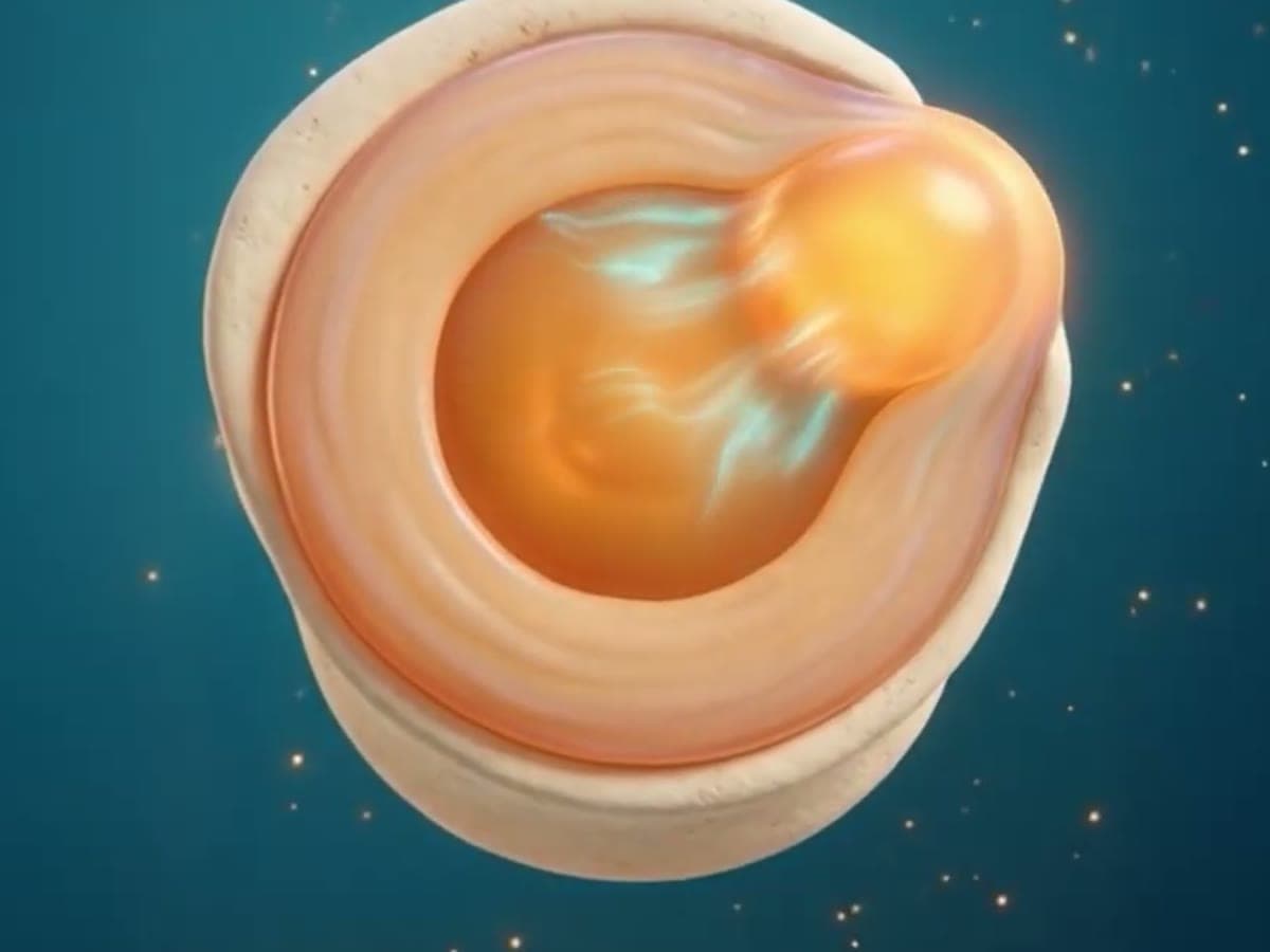Illustration of a lumbar disc bulging out of place, seen from above