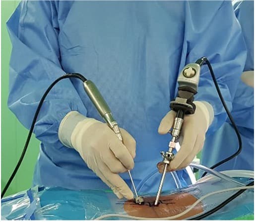 Endoscopic instruments and equipment used during biportal endoscopic spine surgery